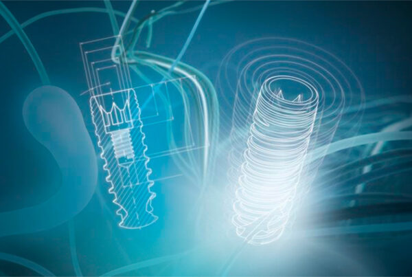 clinica dental en talavera implantes