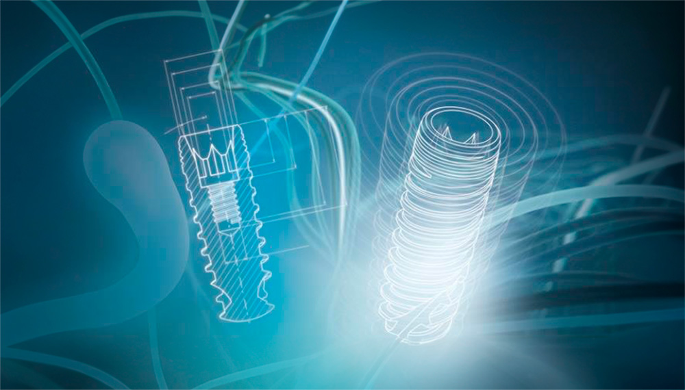 clinica dental en talavera implantes